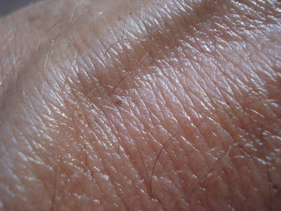 skin cancer symptoms usa